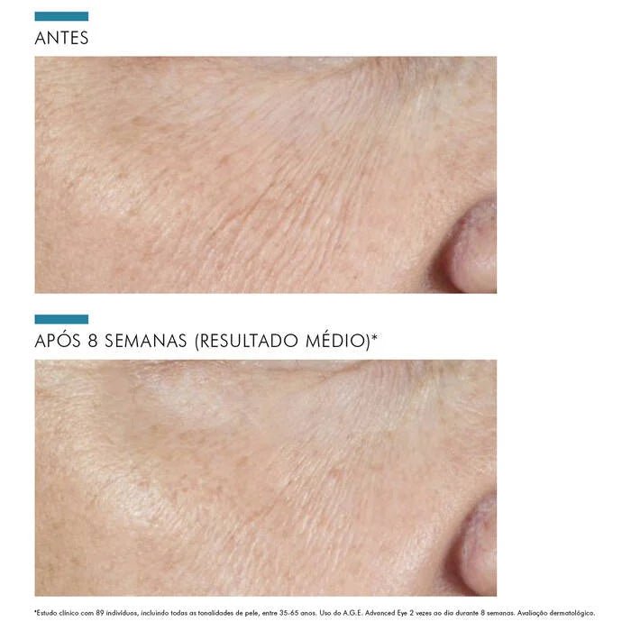 A.G.E. Advanced Eye Anti-idade para o contorno dos olhos - Imagem 5